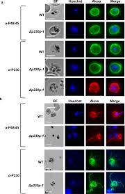 Attēlu rezultāti vaicājumam “Oligonema favogineum plasmodium”