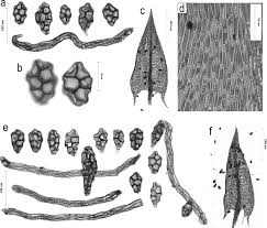 Attēlu rezultāti vaicājumam “Pohlia proligera”