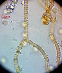 Attēlu rezultāti vaicājumam “Lycogala ustulatum macro”