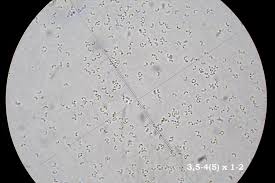 Attēlu rezultāti vaicājumam “Sidera lenis”