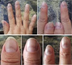 Image result for lunula nail