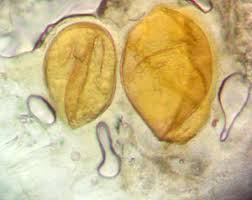 Attēlu rezultāti vaicājumam “Lycogala cf. oleocrystalliferum”