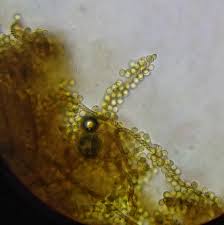 Attēlu rezultāti vaicājumam “Hemitrichia decipiens spores”