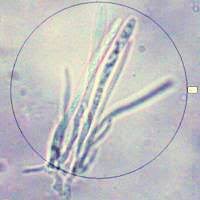 Attēlu rezultāti vaicājumam “Chlorociboria aeruginascens”