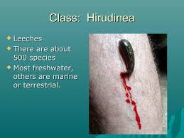 Attēlu rezultāti vaicājumam “Hirudinea”