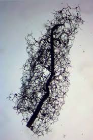 Attēlu rezultāti vaicājumam “Stemonitopsis gracilis”