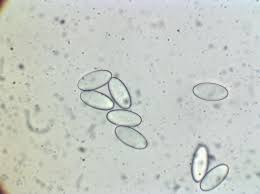 Attēlu rezultāti vaicājumam “Peziza flavida”