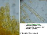 Attēlu rezultāti vaicājumam “Miladina lecithina”