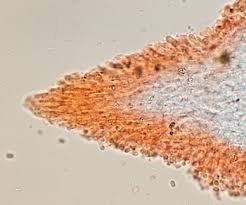 Attēlu rezultāti vaicājumam “Mucronella”