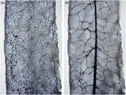 Attēlu rezultāti vaicājumam “Didymium annulisporum sessile”