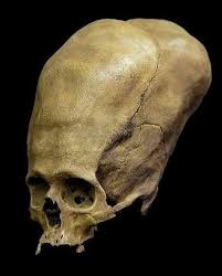 Image result for elongated skulls