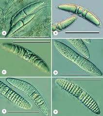 Attēlu rezultāti vaicājumam “Comatricha elegans var. microspora spores”