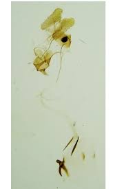 Attēlu rezultāti vaicājumam “Pandemis heparana”