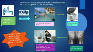 Image result for BMAC