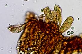 Attēlu rezultāti vaicājumam “Didymium xanthopus macro”