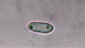 Attēlu rezultāti vaicājumam “Trapeliopsis flexuosa”