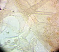 Attēlu rezultāti vaicājumam “Lycogala sphaeroconicum”