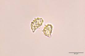 Attēlu rezultāti vaicājumam “Physarum viride var. aurantium spores”