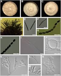 Attēlu rezultāti vaicājumam “Biscogniauxia marginata”