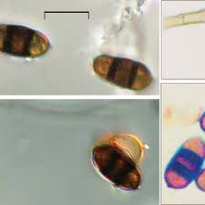 Attēlu rezultāti vaicājumam “Symphytocarpus impexus spores”