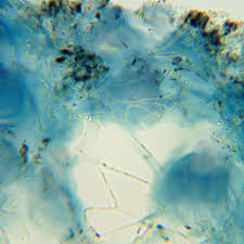 Attēlu rezultāti vaicājumam “Megalaria grossa”