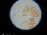 Attēlu rezultāti vaicājumam “Hyalorbilia inflatula”