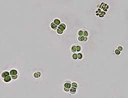 Attēlu rezultāti vaicājumam “Gloeocapsa rupestris”