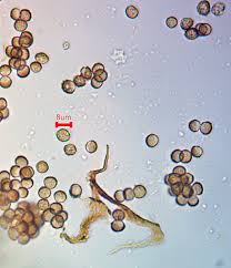 Attēlu rezultāti vaicājumam “Licea chelonoides spores”