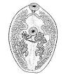 <b>Paragonimus westermani</b>