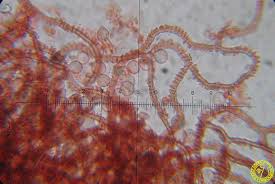 Attēlu rezultāti vaicājumam “Arcyria minuta”