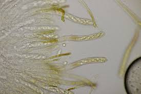 Attēlu rezultāti vaicājumam “Hymenoscyphus sp.”