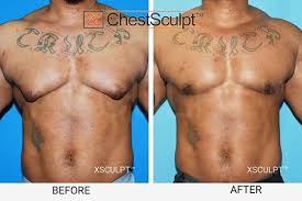 Image result for manboobs