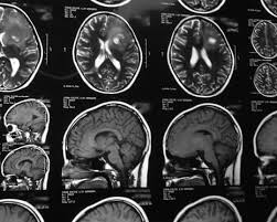 Image result for badalini tehron