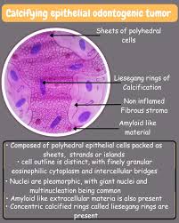 Attēlu rezultāti vaicājumam “Odontoschisma denudatum cells”
