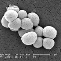 Attēlu rezultāti vaicājumam “Melanospora lagenaria”
