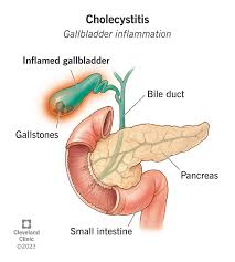 Attēlu rezultāti vaicājumam “gall”