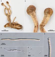 Attēlu rezultāti vaicājumam “Heterotrichia insignis (syn. Arcyria insignis) spores”