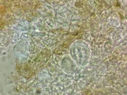 Attēlu rezultāti vaicājumam “Arthonia byssacea”