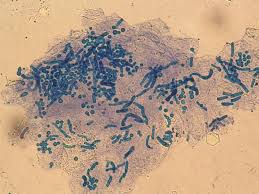 Attēlu rezultāti vaicājumam “Badhamia versicolor spores”