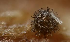 Attēlu rezultāti vaicājumam “Trichia botrytis var. cerifera”