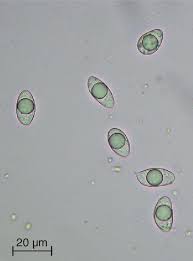 Attēlu rezultāti vaicājumam “Octosporella jungermanniarum”
