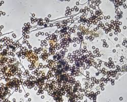Attēlu rezultāti vaicājumam “Didymium proximum spores”
