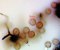 Attēlu rezultāti vaicājumam “Lycogala ustulatum macro”