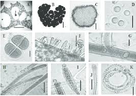 Attēlu rezultāti vaicājumam “Gloeocapsa rupestris”