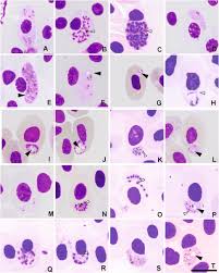 Attēlu rezultāti vaicājumam “Reticularia lobata plasmodium”