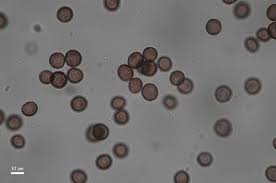 Attēlu rezultāti vaicājumam “Didymium xanthopus spores”