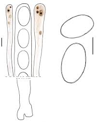 Attēlu rezultāti vaicājumam “Disciotis venosa”