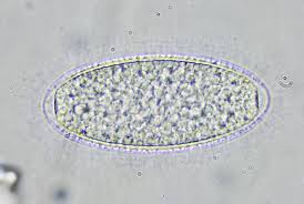 Attēlu rezultāti vaicājumam “Pertusaria leioplaca”