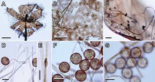 Attēlu rezultāti vaicājumam “Colloderma oculatum plasmodium”
