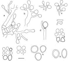 Attēlu rezultāti vaicājumam “Schistidium robustum sporophyte”